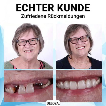 SmileBright™ - Den ganzen Tag lächelndes Vertrauen [50% Rabatt]