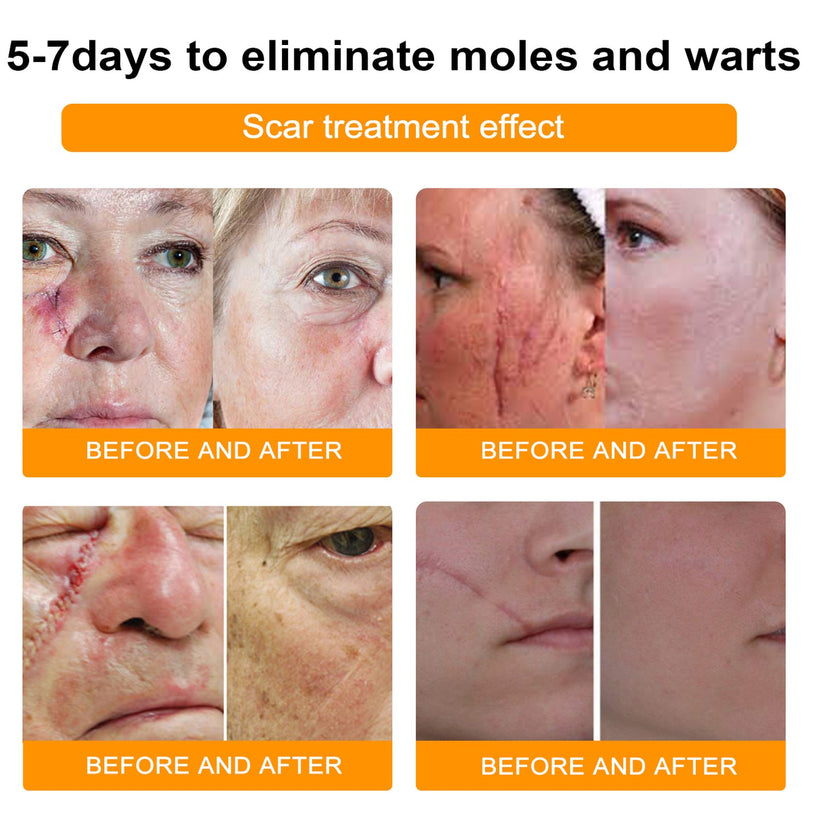 NewYou™ TagLift Bienengift-Behandlung – Schmerzfreie Hauterneuerung für klare, selbstbewusste Haut [1 + 1 Gratis]