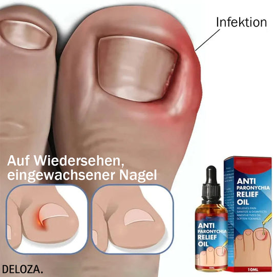 NailHeal™ - Reparatur beschädigter Nägel in 4 Wochen [1 + 1 Gratis]