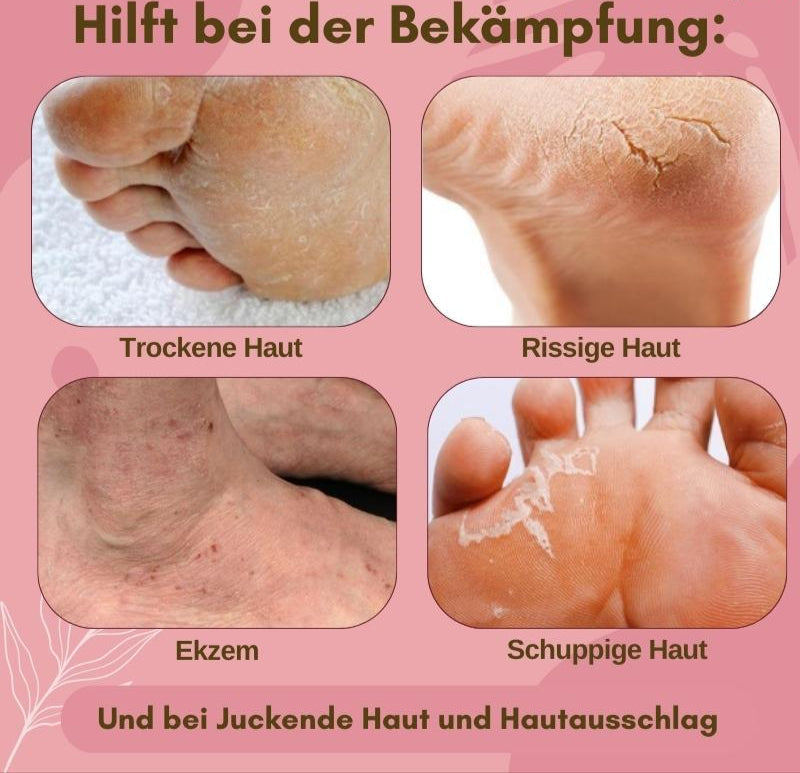 SolereJuve™ – Schnelle Fußpflege für samtig-weiche und entspannte Füße [1 + 1 Gratis]