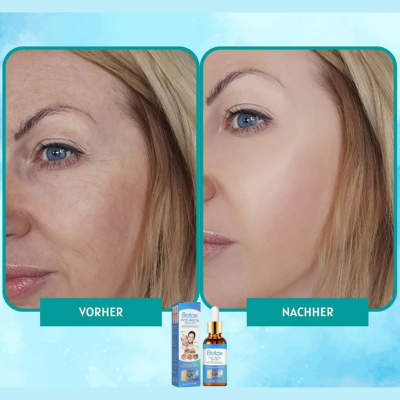 YouthGlow™ – Botox-freies Anti-Aging-Serum für strahlende, jugendliche Haut mit Pflege [1 + 1 Gratis]