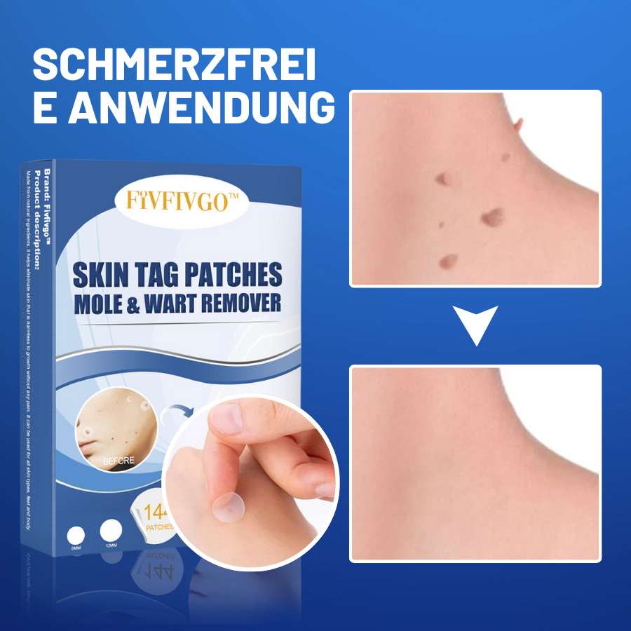 SkinPatch™ – Schmerzfreie, nicht-invasive Behandlung für sichtbar klare, strahlend gesunde Haut [1 + 1 Gratis]