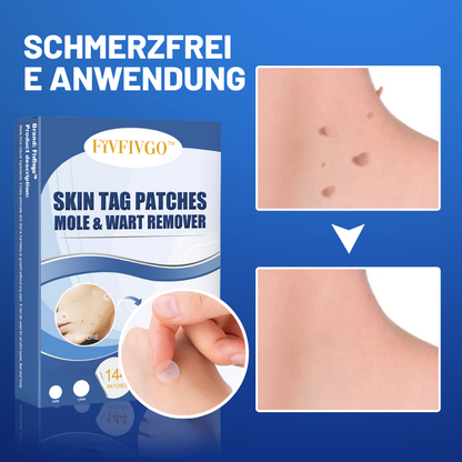 SkinPatch™ – Schmerzfreie, nicht-invasive Behandlung für sichtbar klare, strahlend gesunde Haut [1 + 1 Gratis]