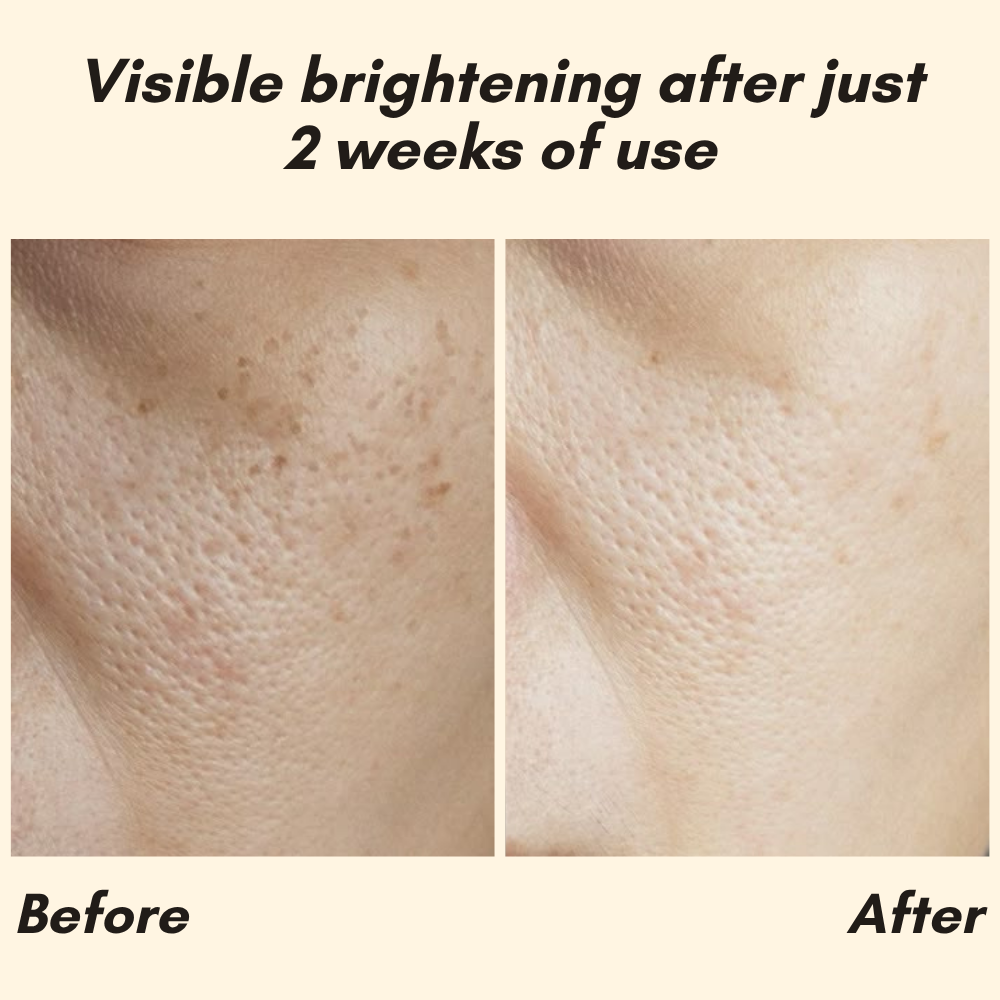 Vitamin C Serum für Hautpflege Gesicht und Körper product image 3