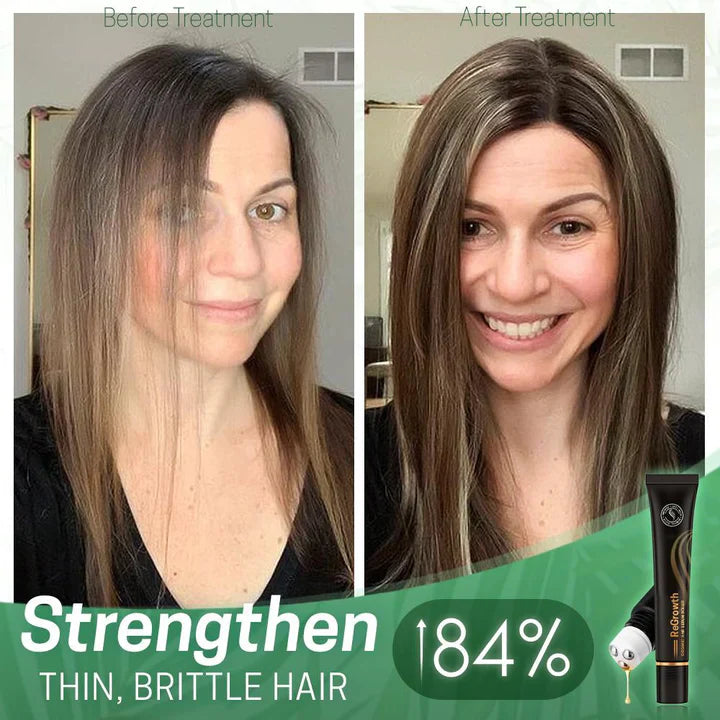 1 + 1 Gratis | NextGrow™ Verhindert kahle Stellen [Letzter Tag Rabatt]