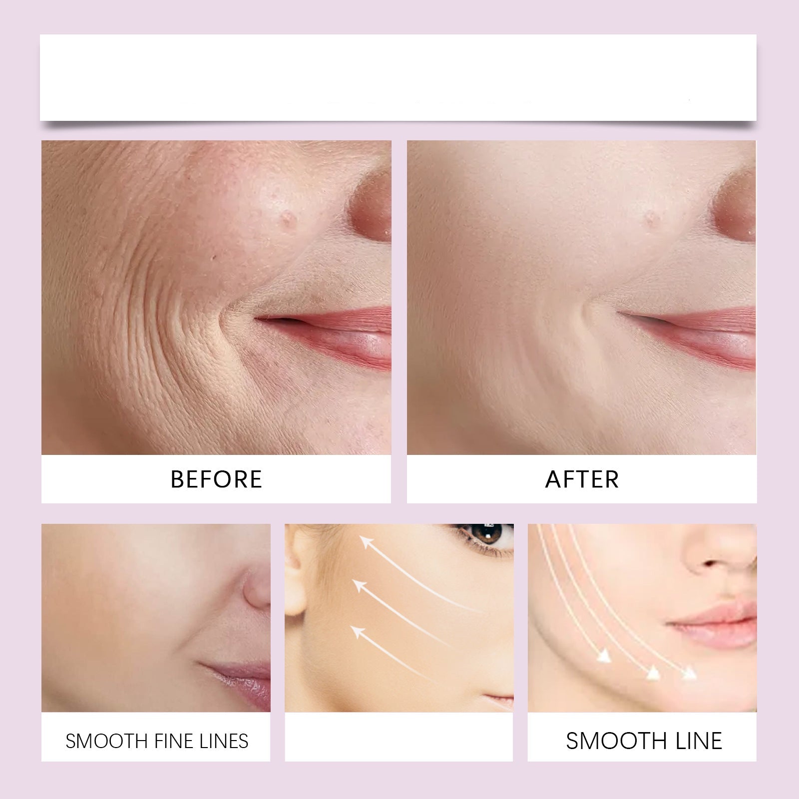 LuxLift™ – Kinn anheben & jugendliche Ausstrahlung in Sekunden verleihen [50 % Rabatt]