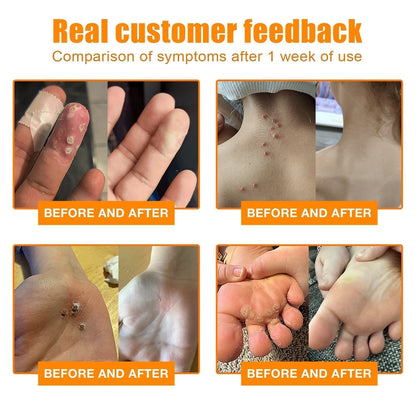 NewYou™ TagLift Bienengift-Behandlung – Schmerzfreie Hauterneuerung für klare, selbstbewusste Haut [1 + 1 Gratis]