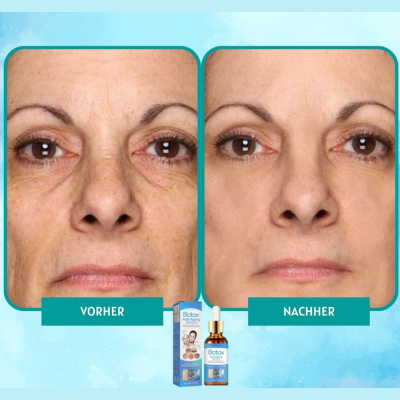 YouthGlow™ – Botox-freies Anti-Aging-Serum für strahlende, jugendliche Haut mit Pflege [1 + 1 Gratis]