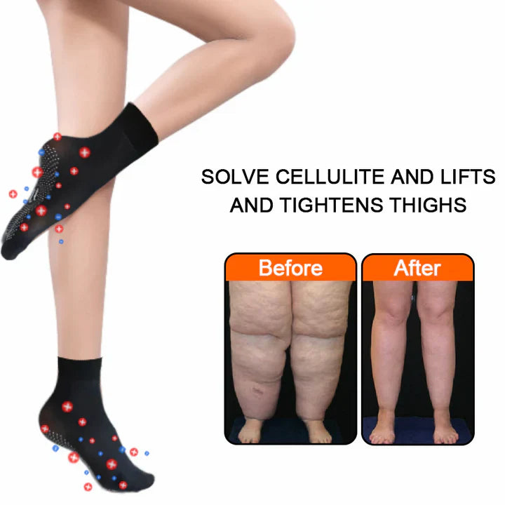 ShapeSocks™ – Der ultimative Trick zur Beschleunigung Ihrer Gewichtsabnahme mit Wirkung [1 + 1 Gratis]