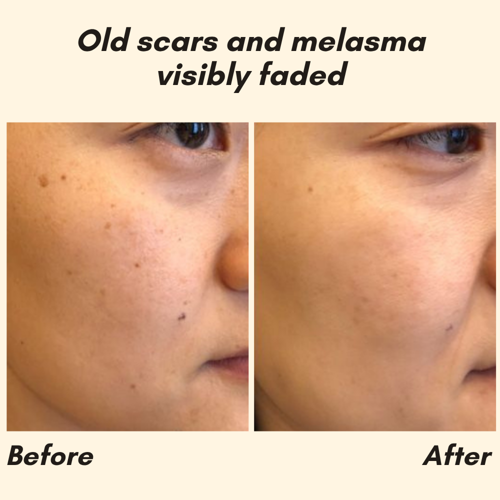 Vitamin C Serum für Hautpflege Gesicht und Körper product image 4