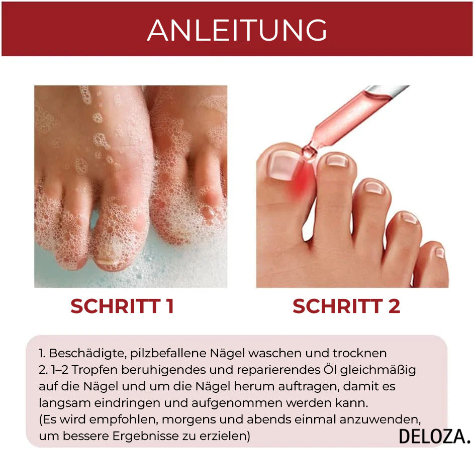 NailHeal™ - Reparatur beschädigter Nägel in 4 Wochen [1 + 1 Gratis]