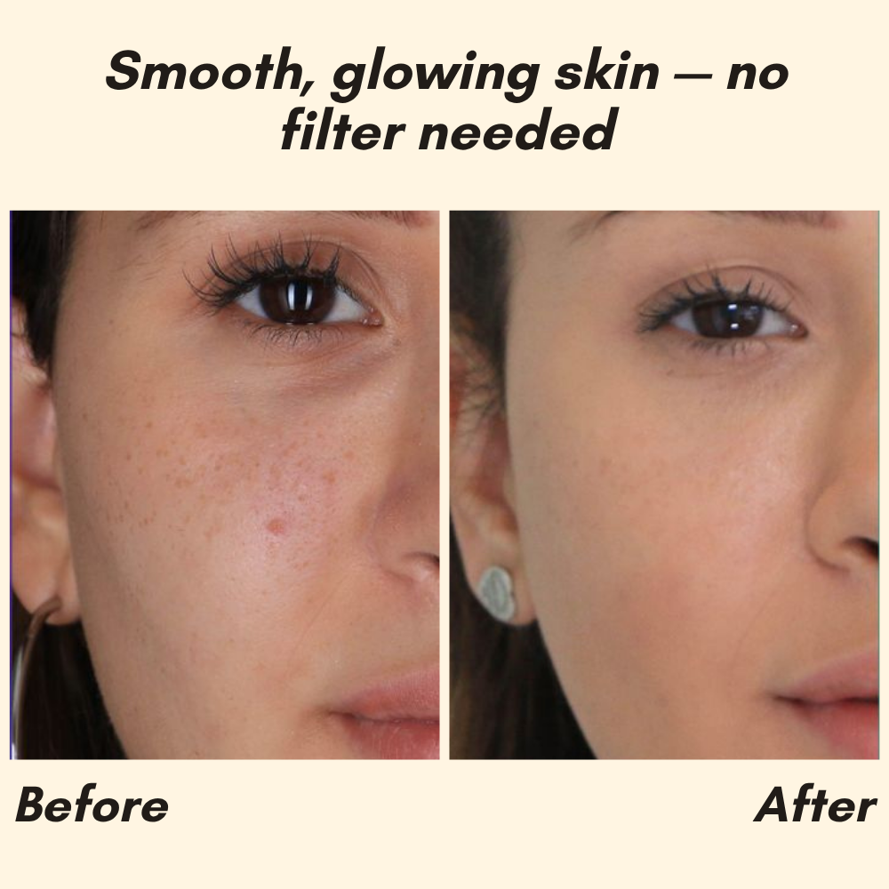 Vitamin C Serum für Hautpflege Gesicht und Körper product image 2