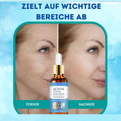 YouthGlow™ – Botox-freies Anti-Aging-Serum für strahlende, jugendliche Haut mit Pflege [1 + 1 Gratis]
