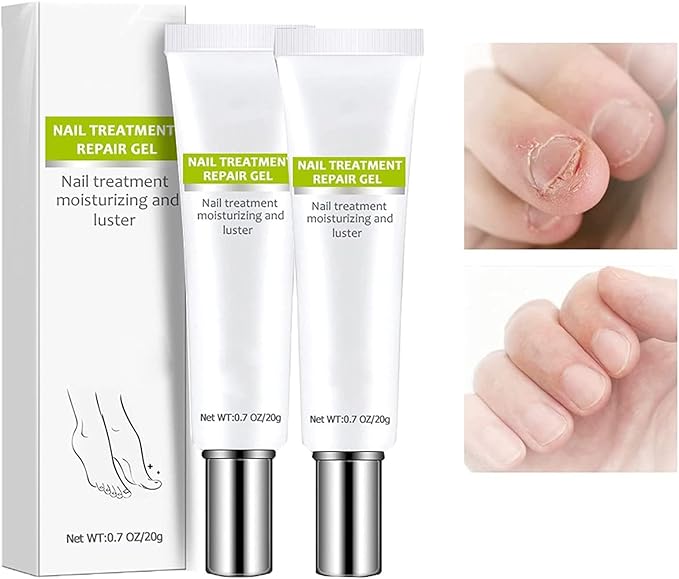 RejuveNail™ – Für nachhaltig stärkere, gesunde und schöne Nägel [1 + 1 Gratis]