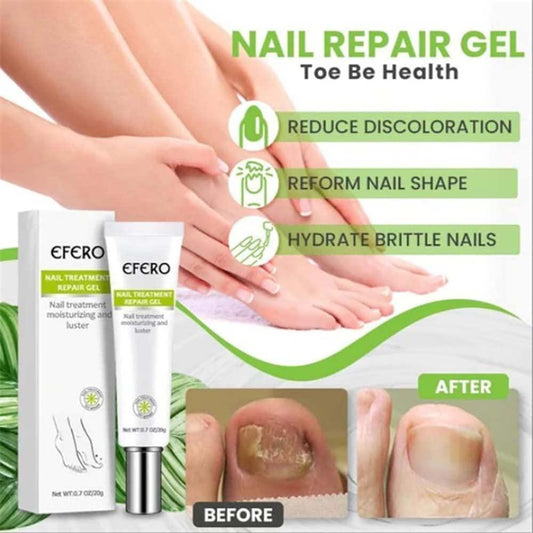 RejuveNail™ – Für nachhaltig stärkere, gesunde und schöne Nägel [1 + 1 Gratis]