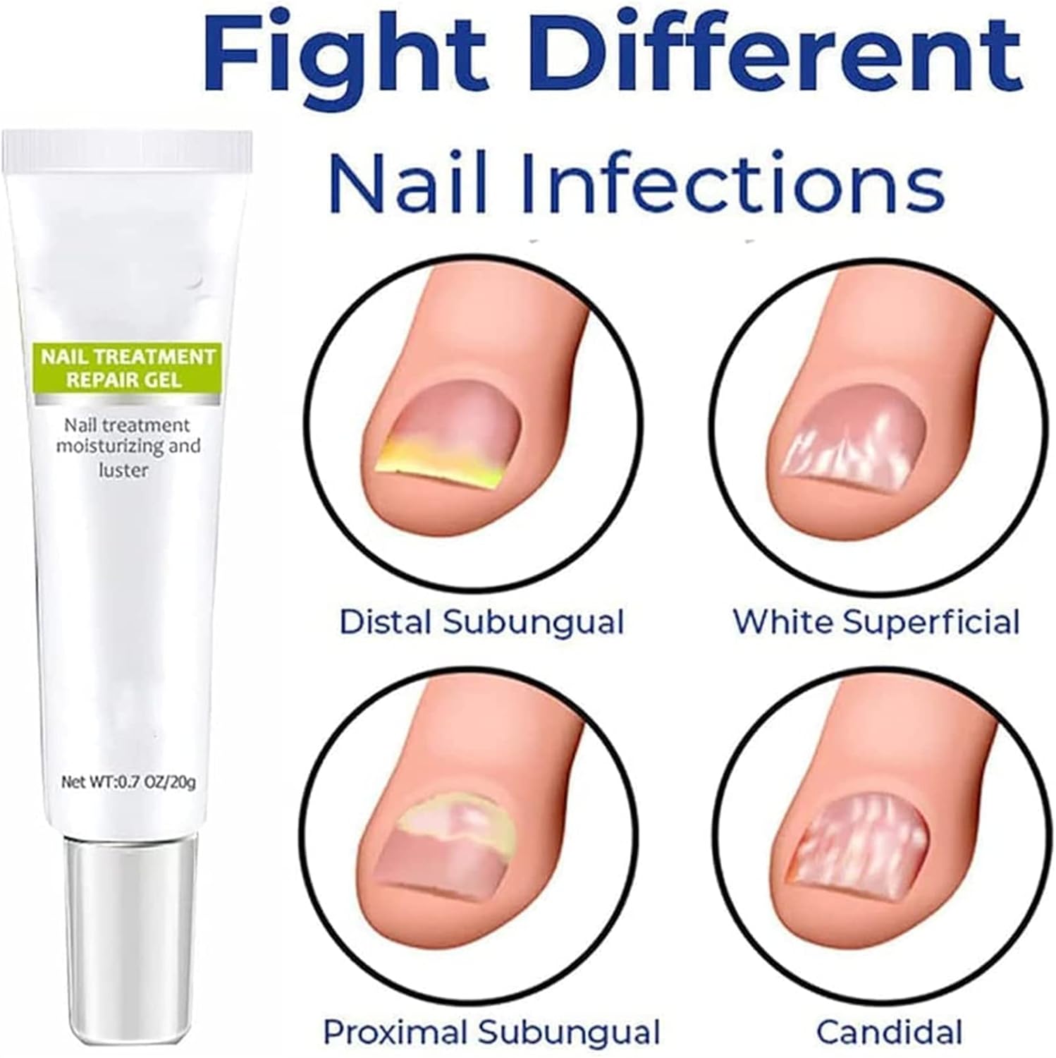 RejuveNail™ – Für nachhaltig stärkere, gesunde und schöne Nägel [1 + 1 Gratis]