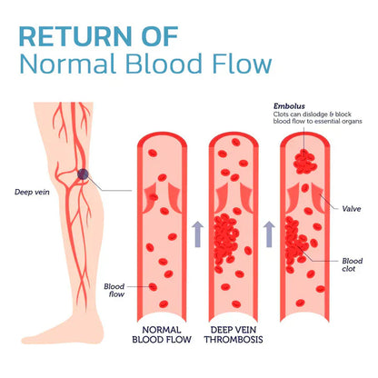 ShapeSocks™ – Der ultimative Trick zur Beschleunigung Ihrer Gewichtsabnahme mit Wirkung [1 + 1 Gratis]