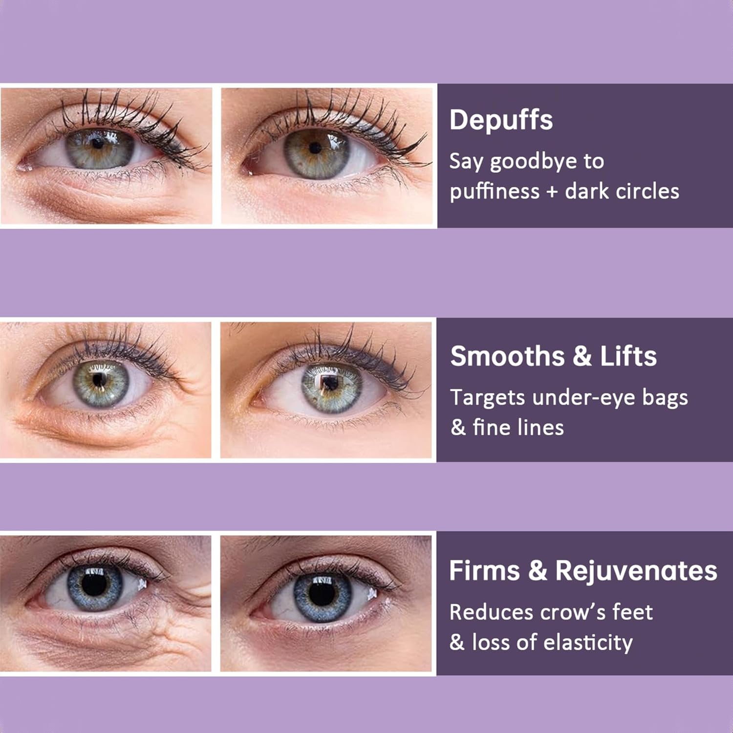 YouthEyes™ – Für sichtbar jüngere, strahlendere und erfrischte Augen [1 + 1 Gratis]