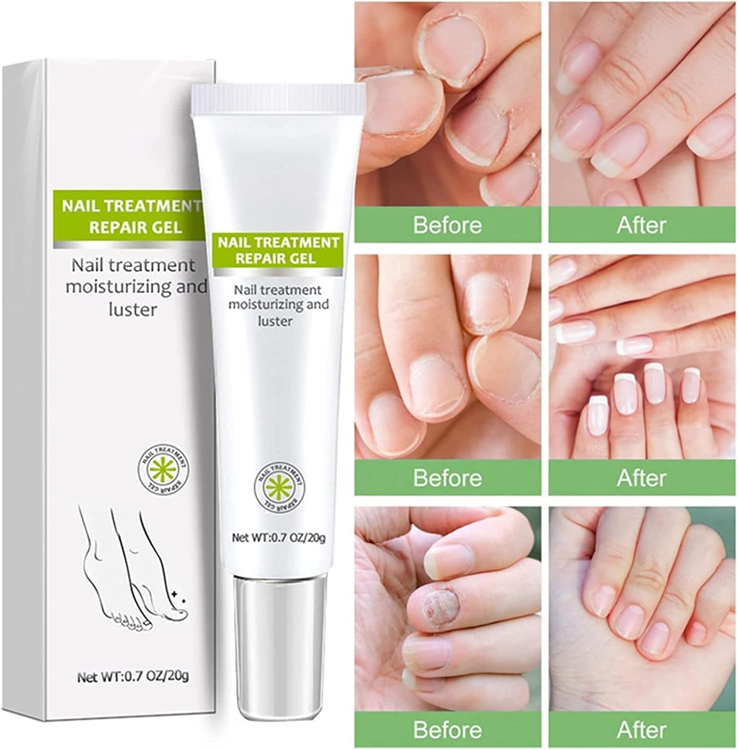 RejuveNail™ – Für nachhaltig stärkere, gesunde und schöne Nägel [1 + 1 Gratis]