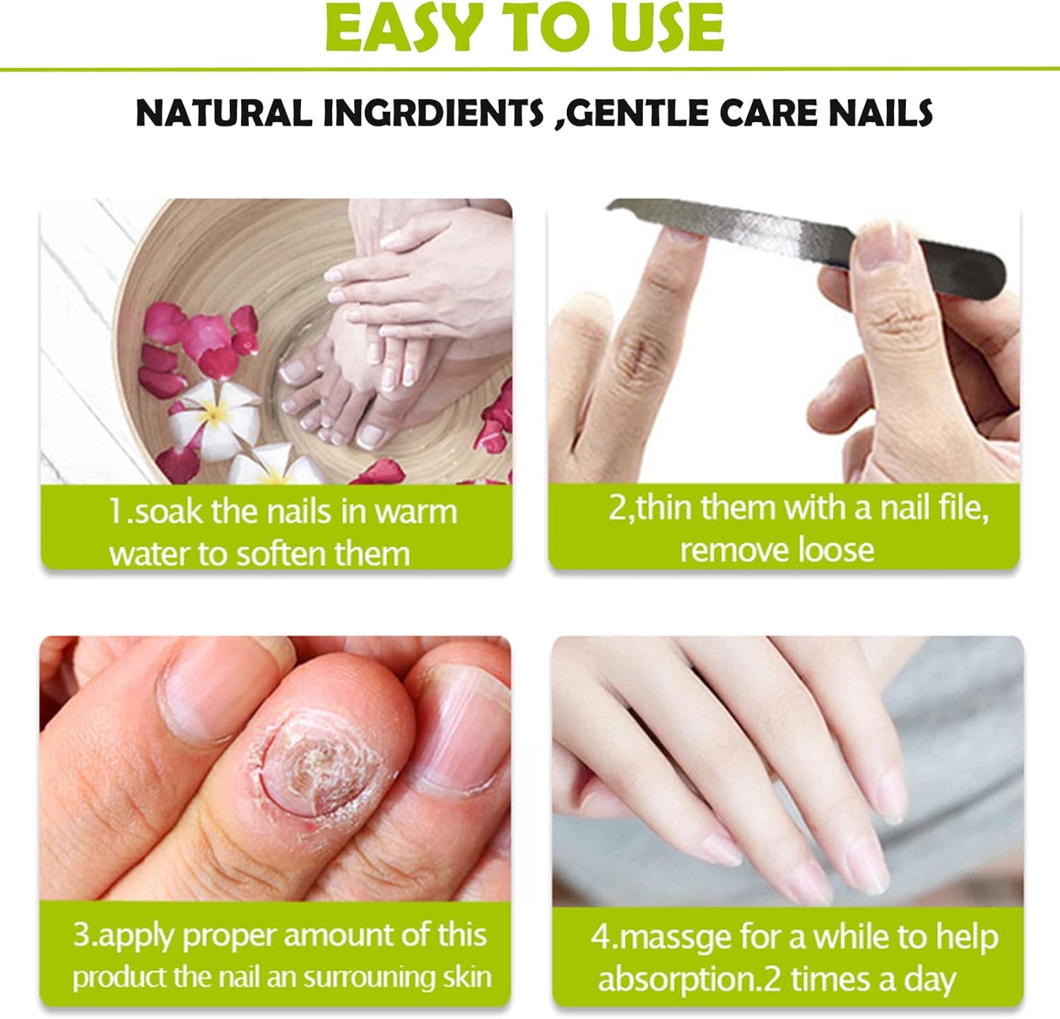 RejuveNail™ – Für nachhaltig stärkere, gesunde und schöne Nägel [1 + 1 Gratis]