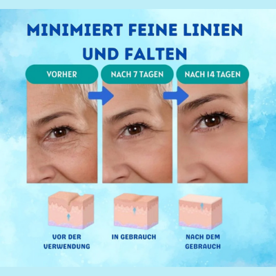 YouthGlow™ – Botox-freies Anti-Aging-Serum für strahlende, jugendliche Haut mit Pflege [1 + 1 Gratis]