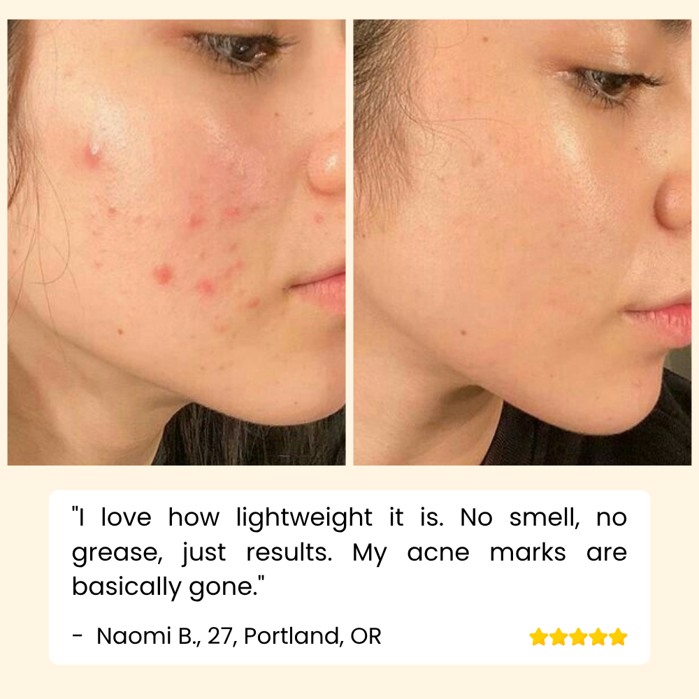 Vitamin C Serum für Hautpflege Gesicht und Körper product image 5