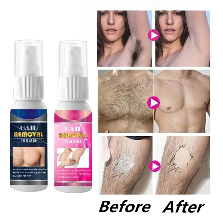 FreshBare™ – Schmerzfreie Haarentfernung für seidige, gesunde und glatte Haut [1 + 1 Gratis]
