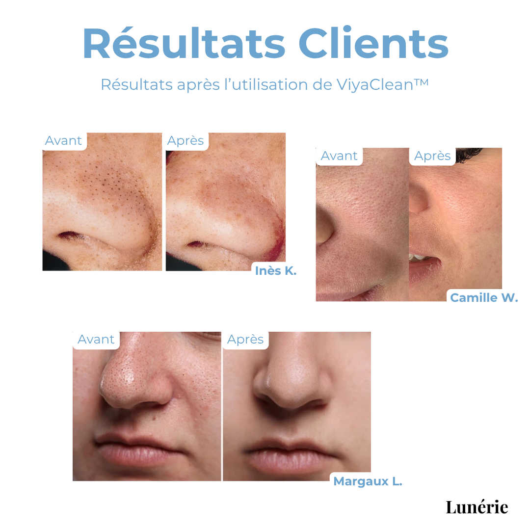 SkinClear™ – Porentiefes Reinigungsserum mit Salicylsäure und natürlichen Extrakten [50% Rabatt]