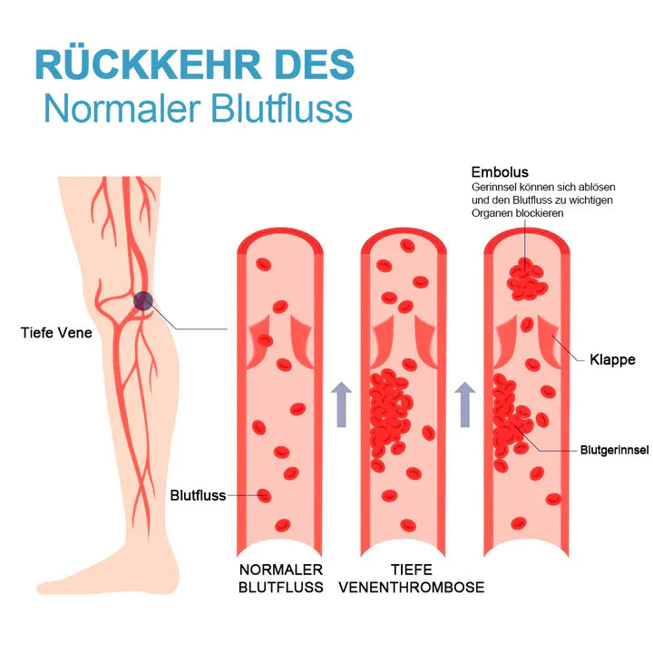 SlimSock™ – Tourmaline Ionic Body Shaping Stretch Socken | 1 + 2 GRATIS