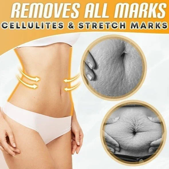 BellyDrain™ – Natürliche Öle zur sicheren Cellulite-Verbrennung für Haut [1 + 1 Gratis]