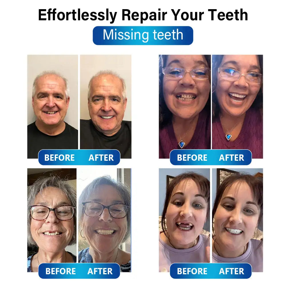 Futusly™ – Professionelle Blaulicht-Härtelampe mit langlebigen Prothesenmaterialien [50 % Rabatt]