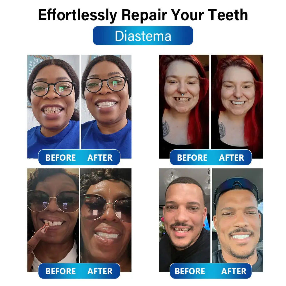 Futusly™ – Professionelle Blaulicht-Härtelampe mit langlebigen Prothesenmaterialien [50 % Rabatt]