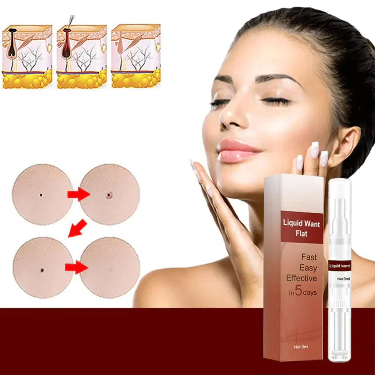 1 + 1 Gratis |  WipeOff™ - Hartnäckige Flecken und Warzen entfernen