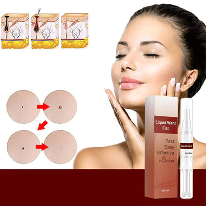 1 + 1 Gratis |  WipeOff™ - Hartnäckige Flecken und Warzen entfernen