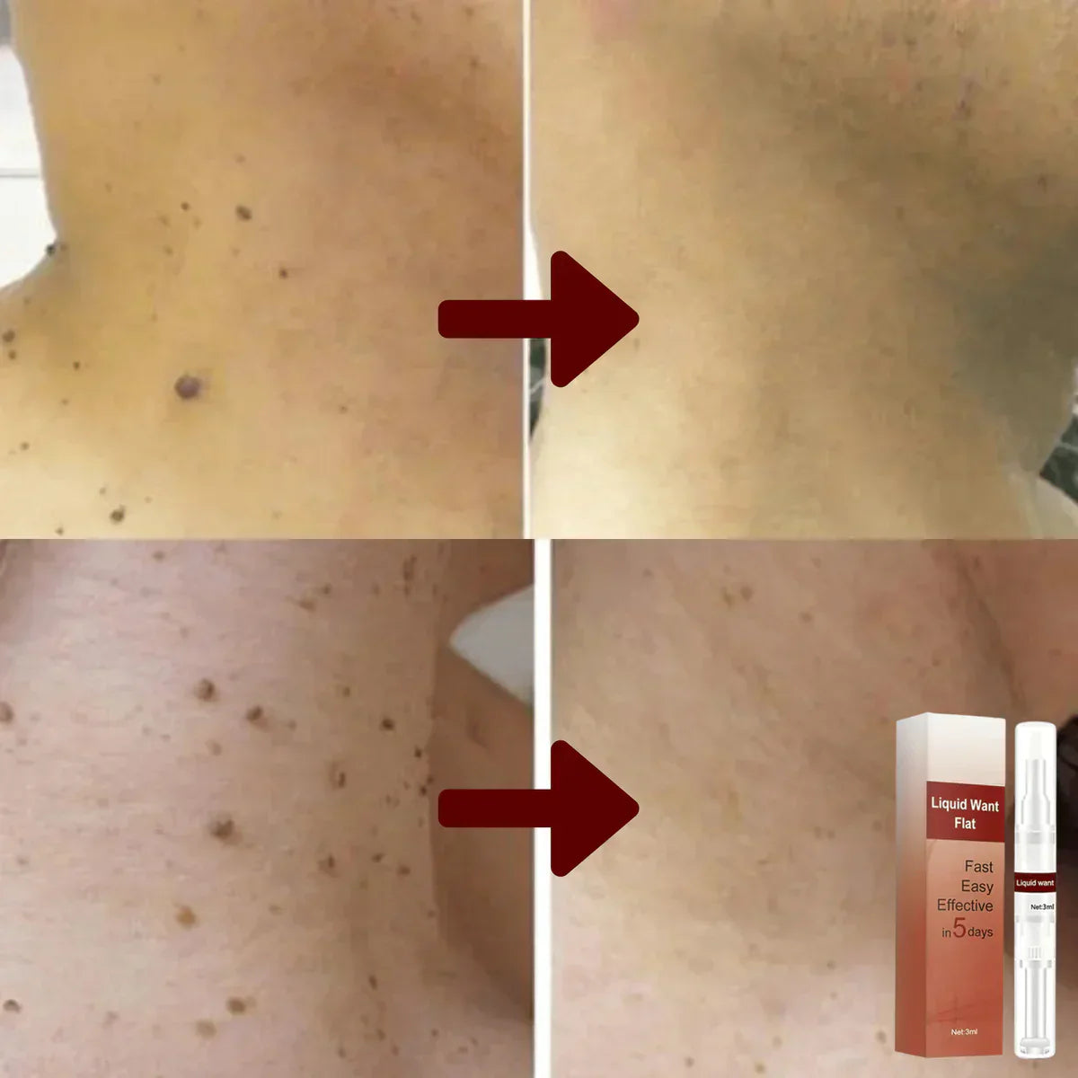 1 + 1 Gratis |  WipeOff™ - Hartnäckige Flecken und Warzen entfernen