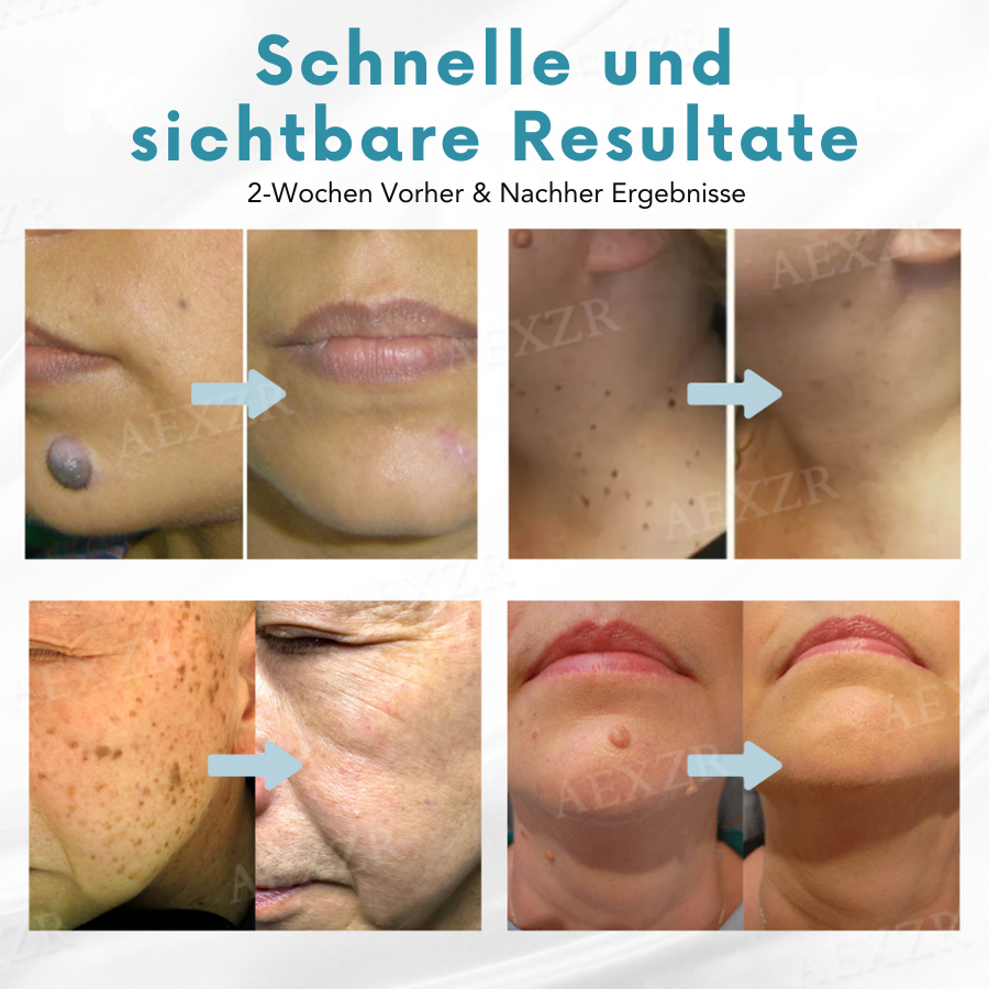 Radiant™ – Schnell sichtbare Hautverjüngung [1 + 1 Gratis]