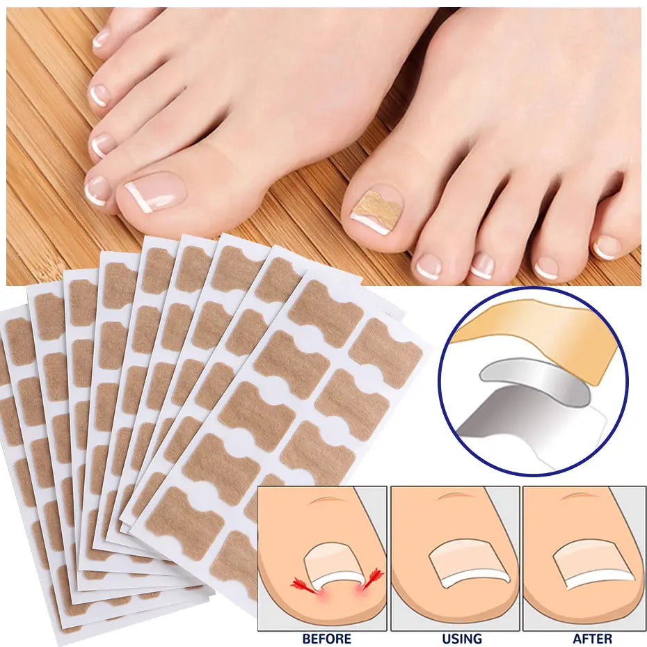 HealthyNail™ – Pflegen & verschönern Sie Ihre natürlichen Nägel auf sanfte, nachhaltige Weise [25 + 25 Gratis]