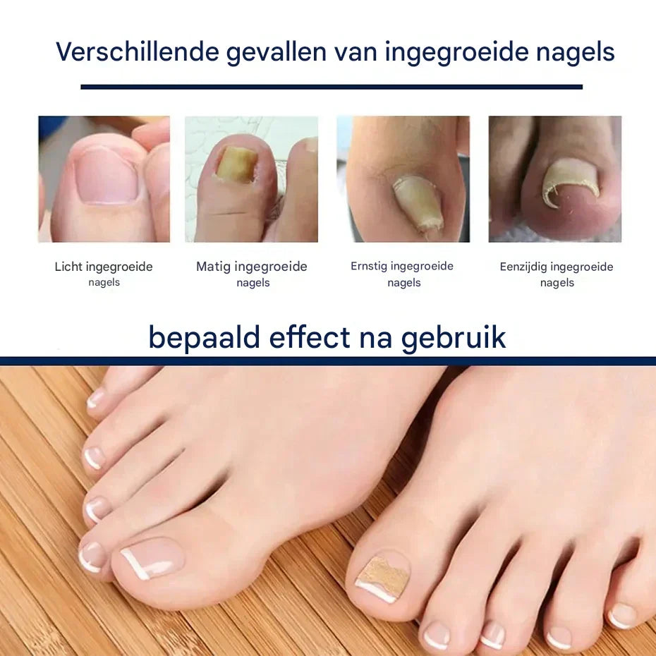 HealthyNail™ – Pflegen & verschönern Sie Ihre natürlichen Nägel auf sanfte, nachhaltige Weise [25 + 25 Gratis]