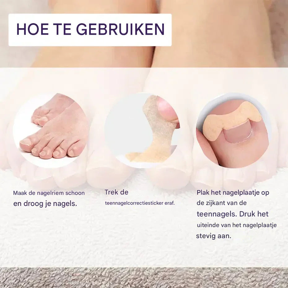 HealthyNail™ – Pflegen & verschönern Sie Ihre natürlichen Nägel auf sanfte, nachhaltige Weise [25 + 25 Gratis]
