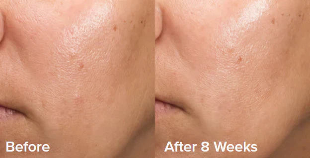GlowEssence™ – Das einzige Peeling-Gel für glatte & strahlende Haut [50 % Rabatt]