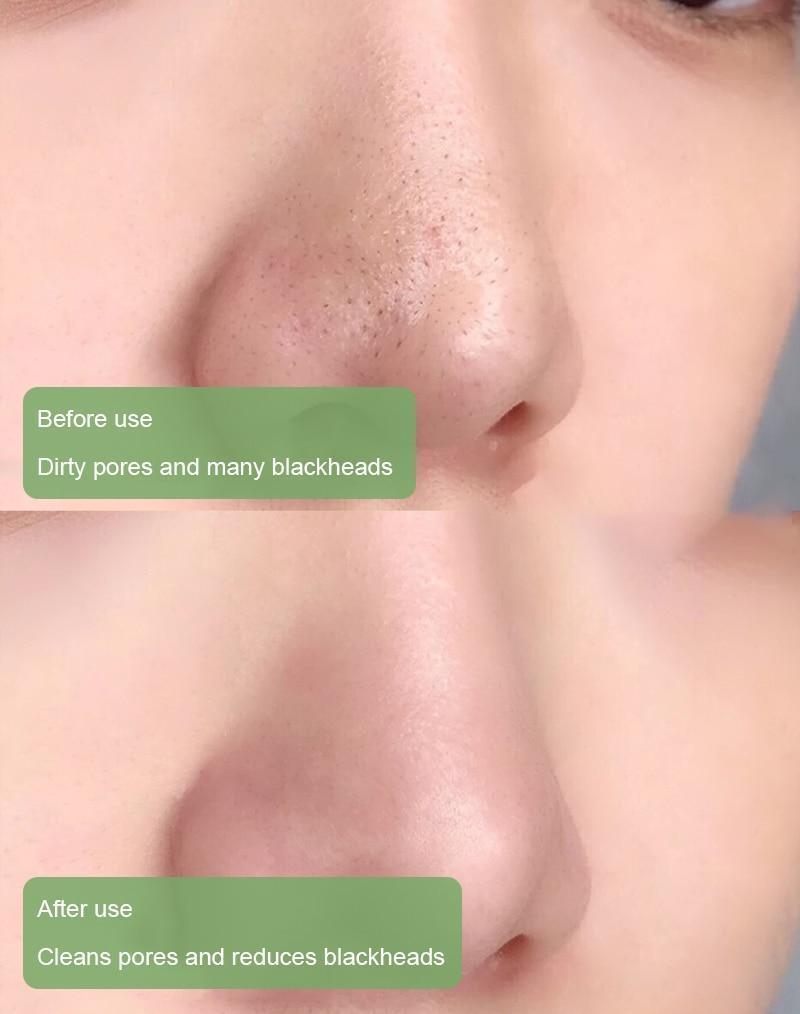Grüner Tee Gesichtsmaske Stick Tiefenreinigung Porenpflege product image 6