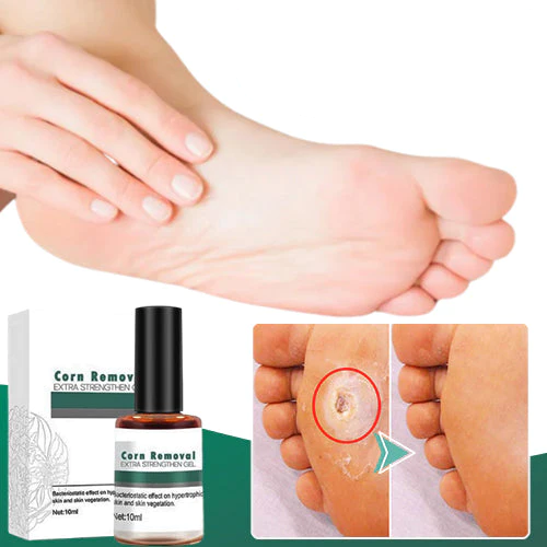 CleanFeet™ – Hühneraugen- und Hornhautentferner für besonders starke, schnelle Linderung [1 + 1 Gratis]