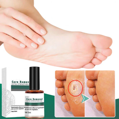 CleanFeet™ – Hühneraugen- und Hornhautentferner für besonders starke, schnelle Linderung [1 + 1 Gratis]