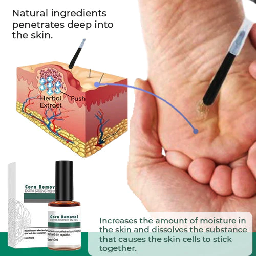 CleanFeet™ – Hühneraugen- und Hornhautentferner für besonders starke, schnelle Linderung [1 + 1 Gratis]