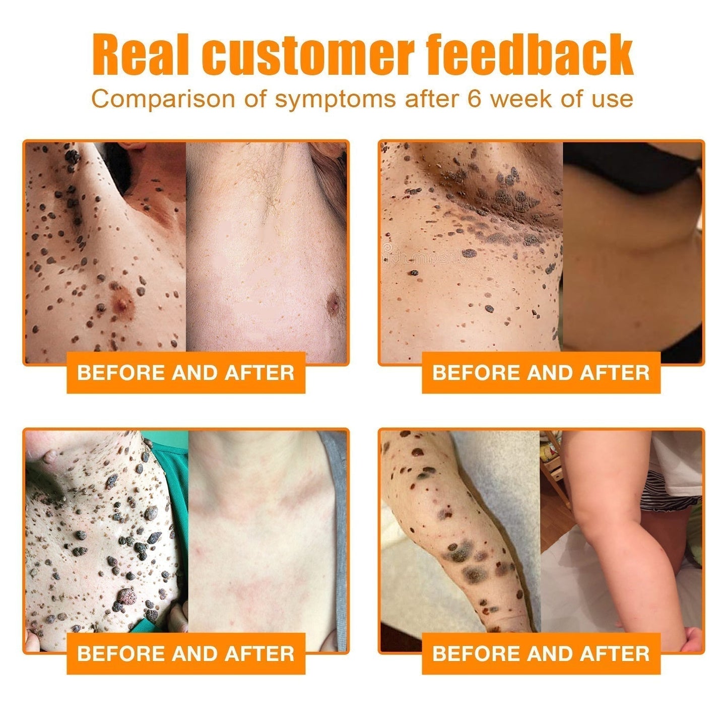 NewYou™ TagLift Bienengift-Behandlung – Schmerzfreie Hauterneuerung für klare, selbstbewusste Haut [1 + 1 Gratis]