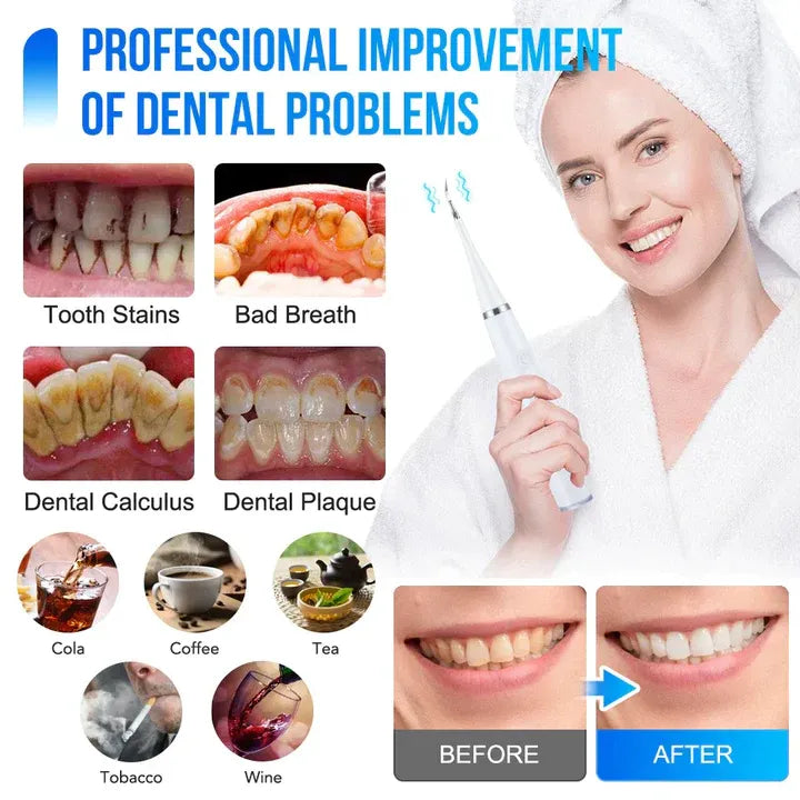 ToothCleaner™ – Effektive Pflege für strahlend gesunde Zähne! [50 % Rabatt]