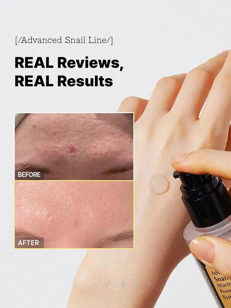 GlowFace™ – 96,3 % Schneckenschleim für Hautregeneration und intensive Feuchtigkeit [50% Rabatt]