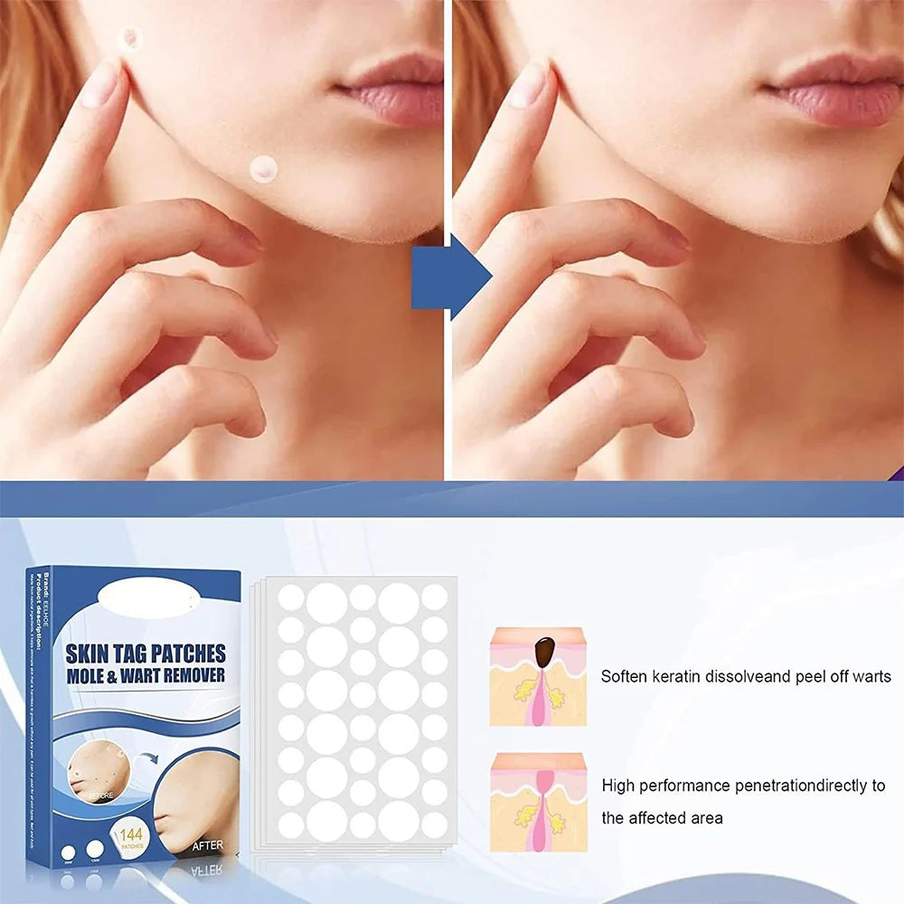 SkinPatch™ – Schmerzfreie, nicht-invasive Behandlung für sichtbar klare, strahlend gesunde Haut [1 + 1 Gratis]