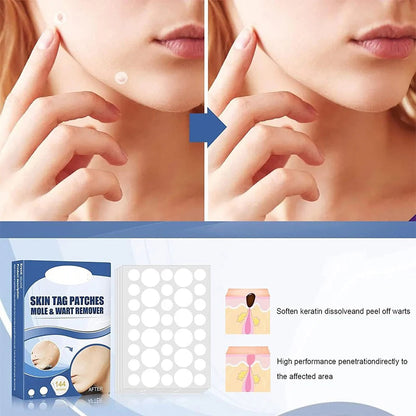 SkinPatch™ – Schmerzfreie, nicht-invasive Behandlung für sichtbar klare, strahlend gesunde Haut [1 + 1 Gratis]