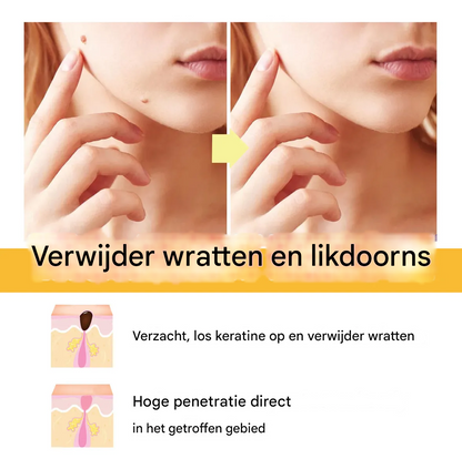 BeeNaturale™ – Entfernt Hautflapjes und Flecken sanft und effektiv [1 + 1 Gratis]